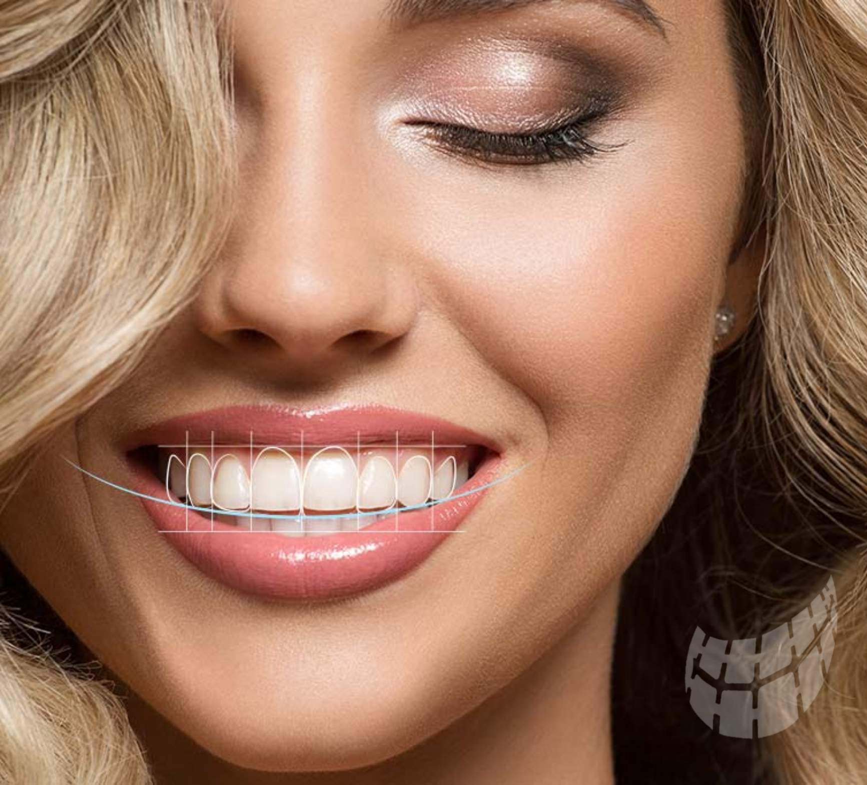 La mayoria de las malposiciones de los dientes se pueden resolver con un tratamiento de ortodoncia manteniendo intacta la morfologia dentaria