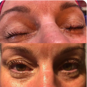Lash Lift including Tint