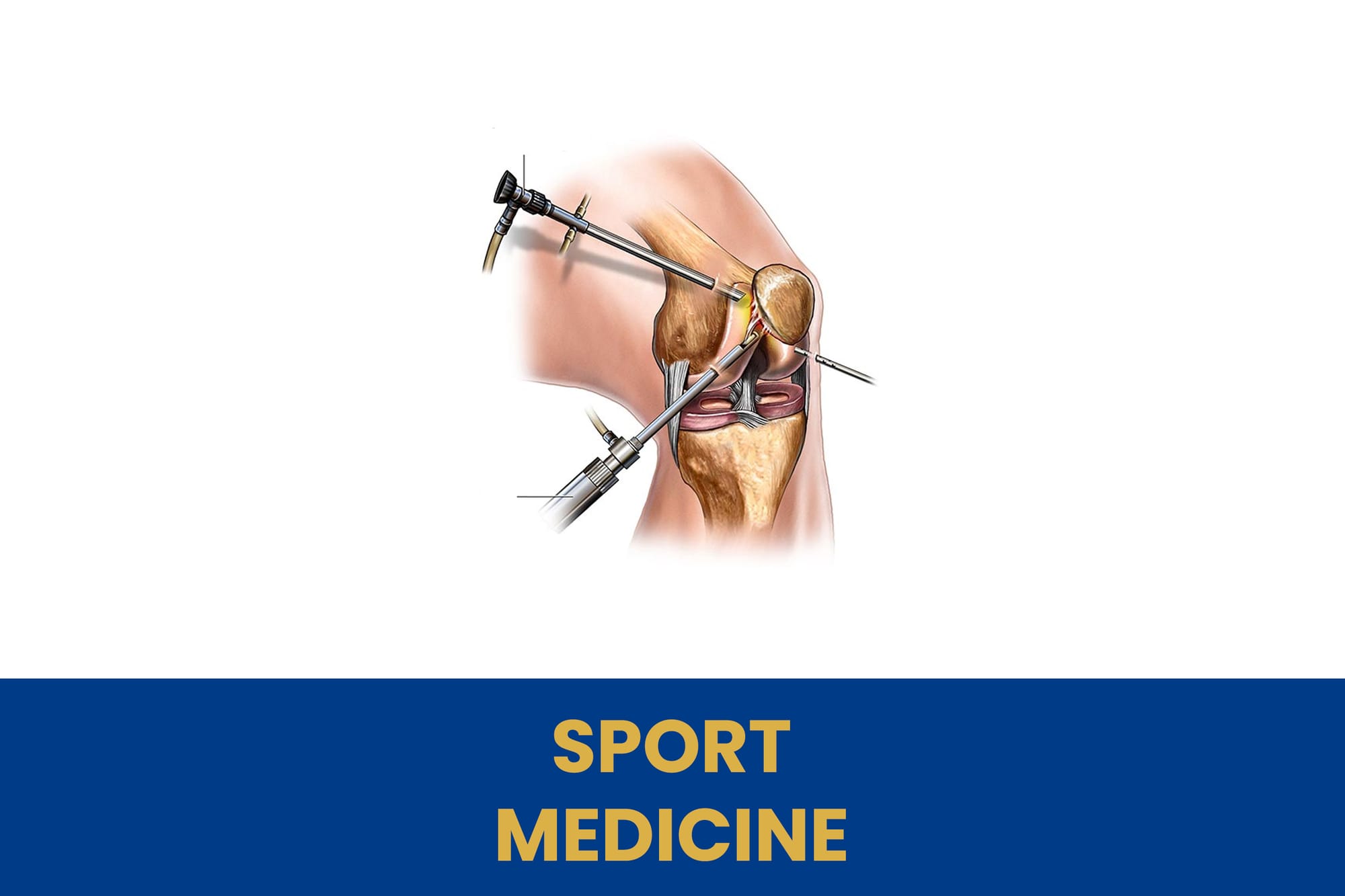 SPORT MEDICINE