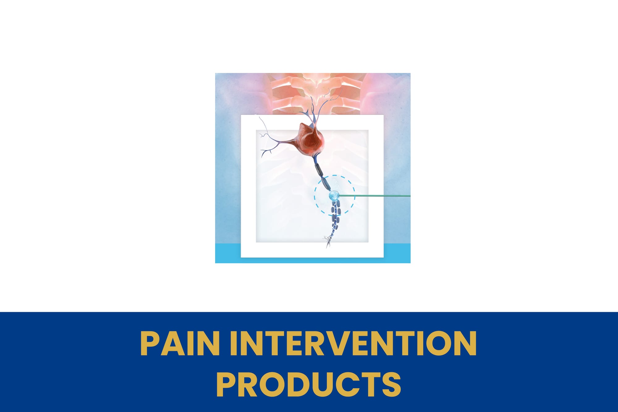 PAIN INTERVENTION