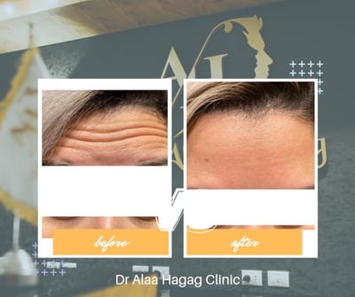 دكتور تجميل الوجه في التجمع