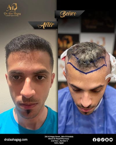 دليلك الشامل للعناية بالشعر والبشرة: أفضل الأطباء والعيادات في مصر والسعودي