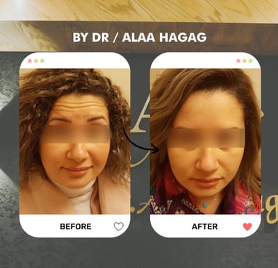 دكتور تجميل الوجه في التجمع