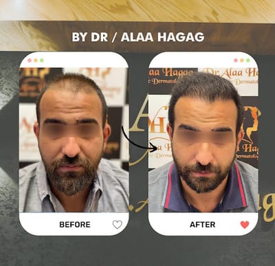 دكتور تجميل الوجه في التجمع: تخصصات دقيقة ونتائج طبيعية