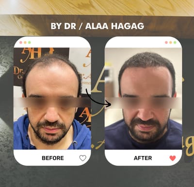 علاج الصنادح