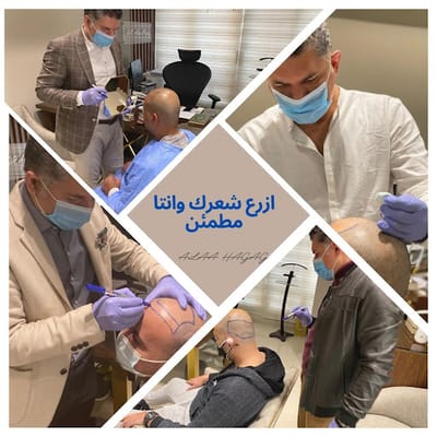 أفضل دكتور زراعة شعر في السعودية