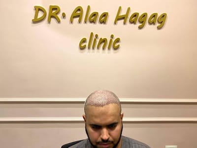 مركز زراعة الشعر في السعودية