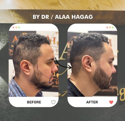 دكتور تجميل في السعودية