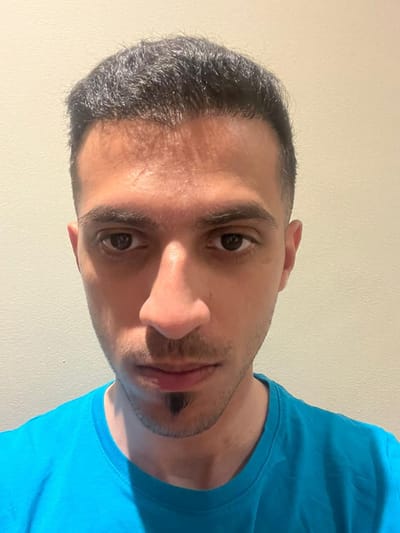 علاج الصنادح