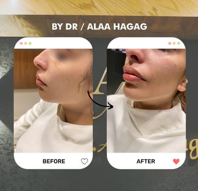 دكتور تجميل الوجه في التجمع