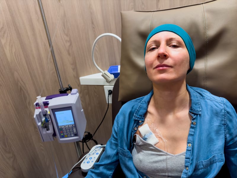 Vintage NG, Chemo Caps
