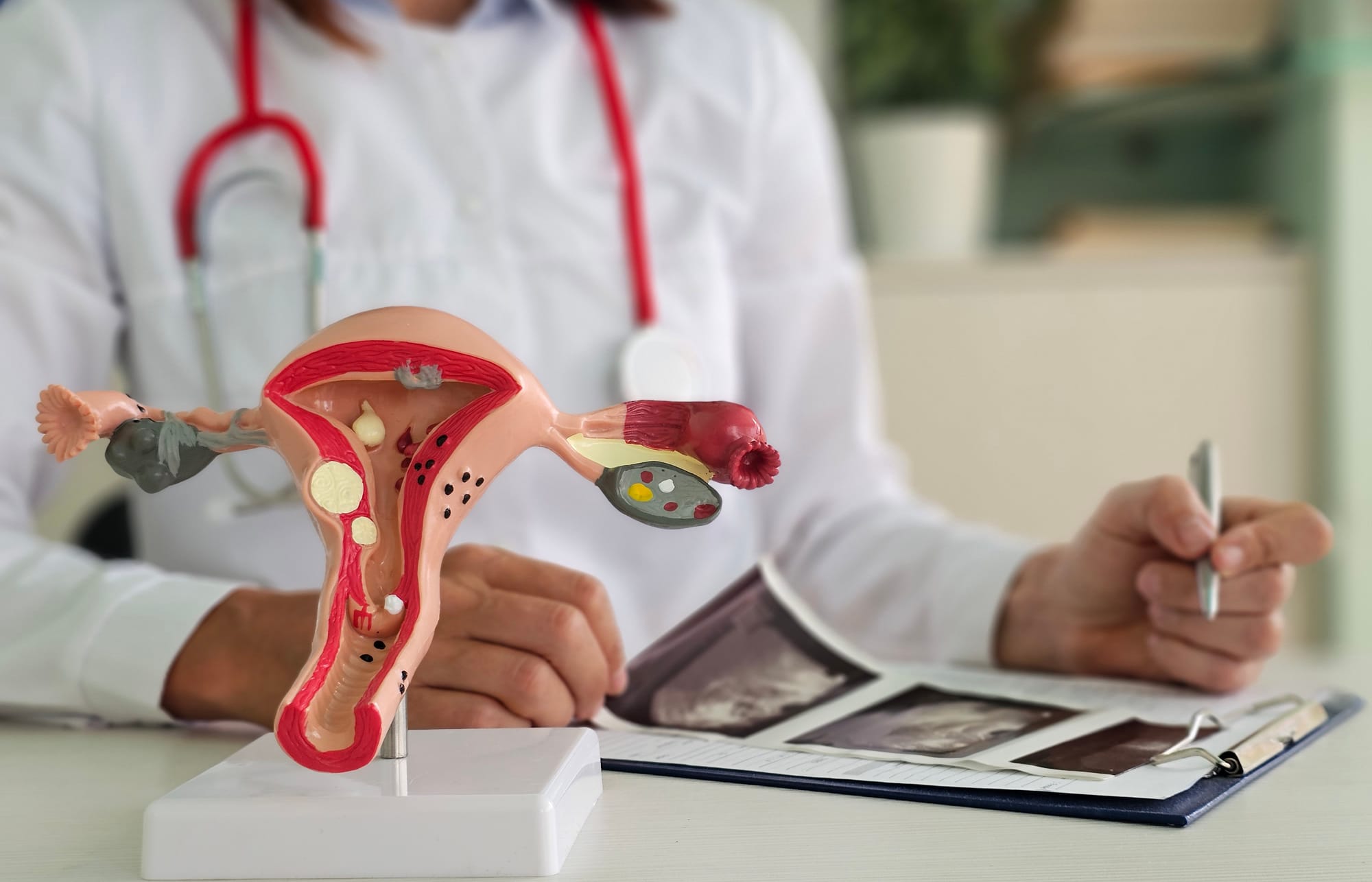 Vaginisme traitement indolore : c’est reprendre confiance en sécurité