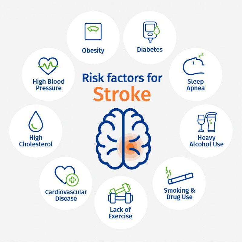 World Stroke Organization - Global Fact Sheet