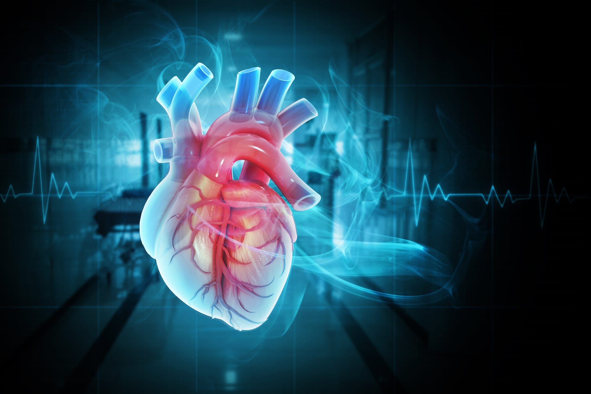New Stroke Therapies