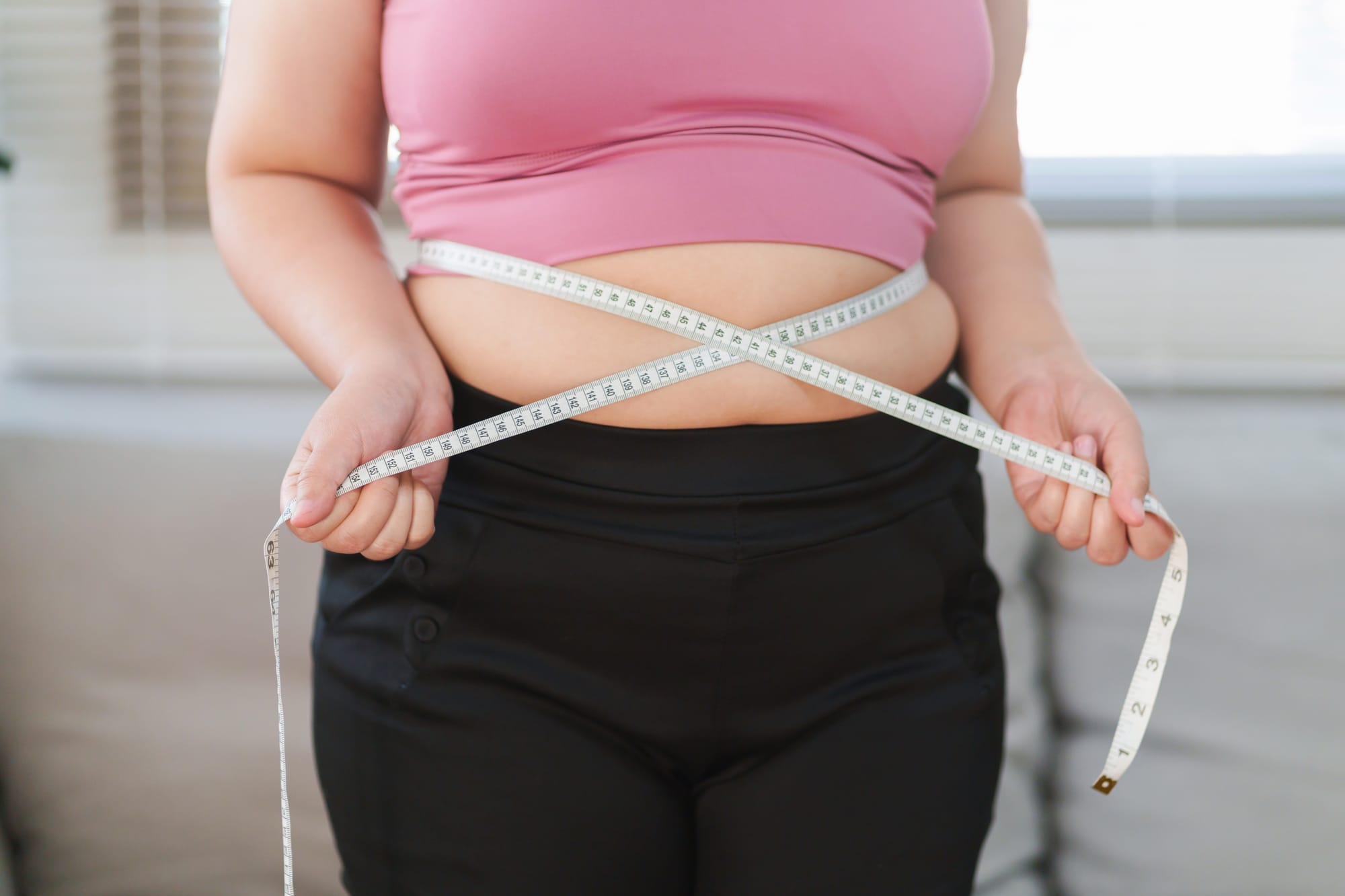 Comparative Guide to Obesity Treatments at Obesity Expert Turkey: Sleeve, Bypass, Gastric Balloon & Gastric Botox
