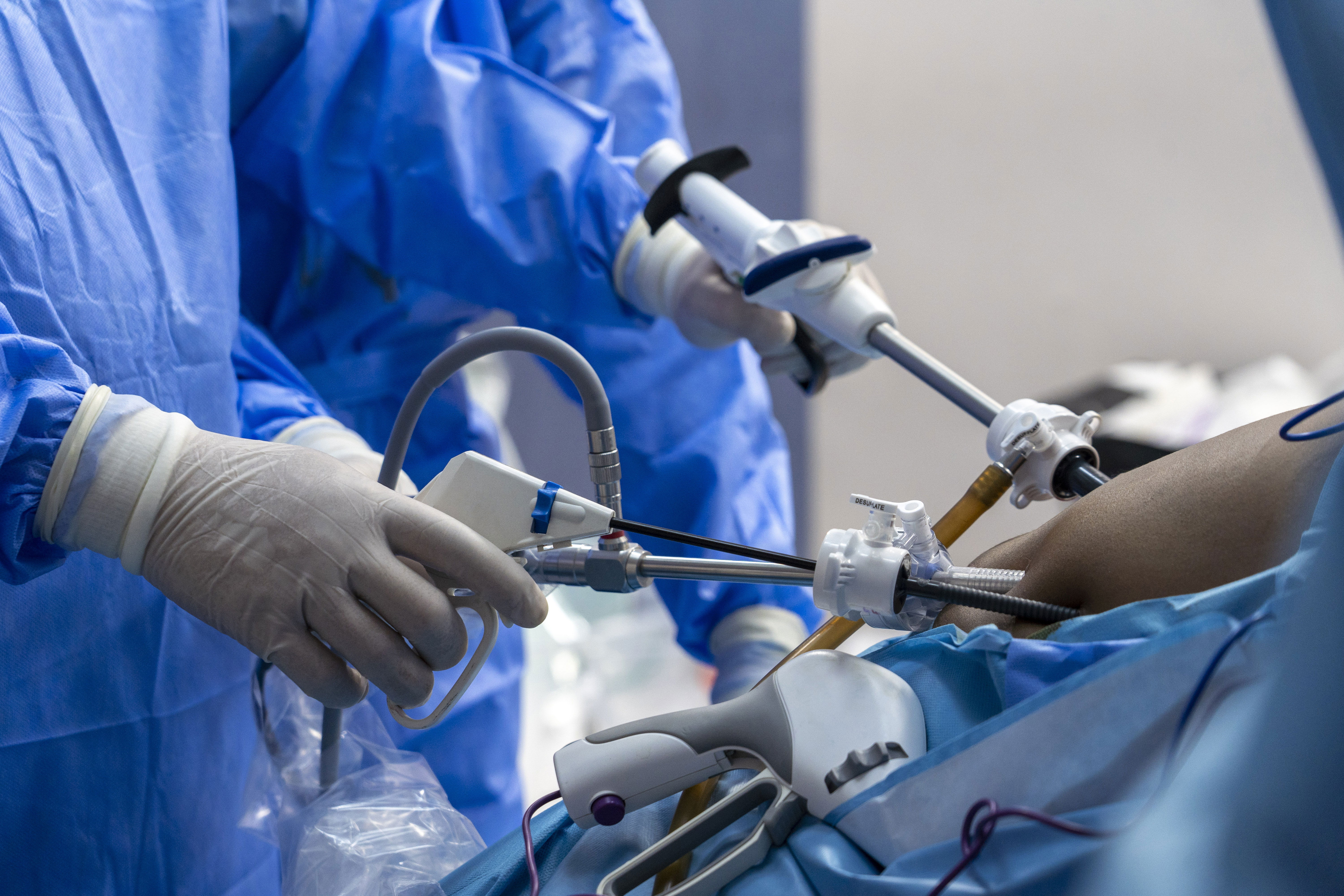 Gastric Sleeve ou Bypass Gastrique