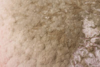 Zeolit és alginit a talaj termékenységéért