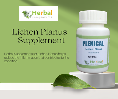 Herbal Treatments for Lichen Planus: What Works?