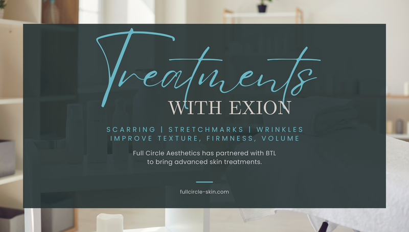 Meet Exion