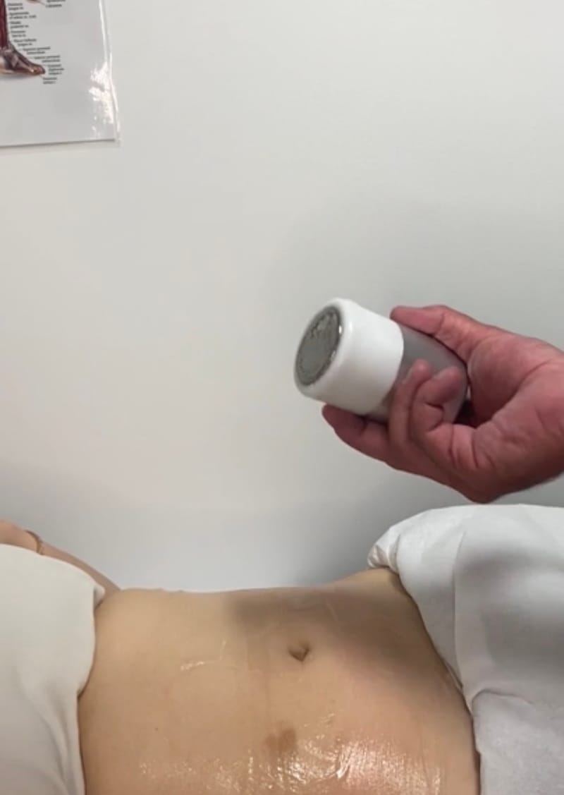 Ultrasonic Sound Cavitation in Birmingham: Advanced Fat Loss