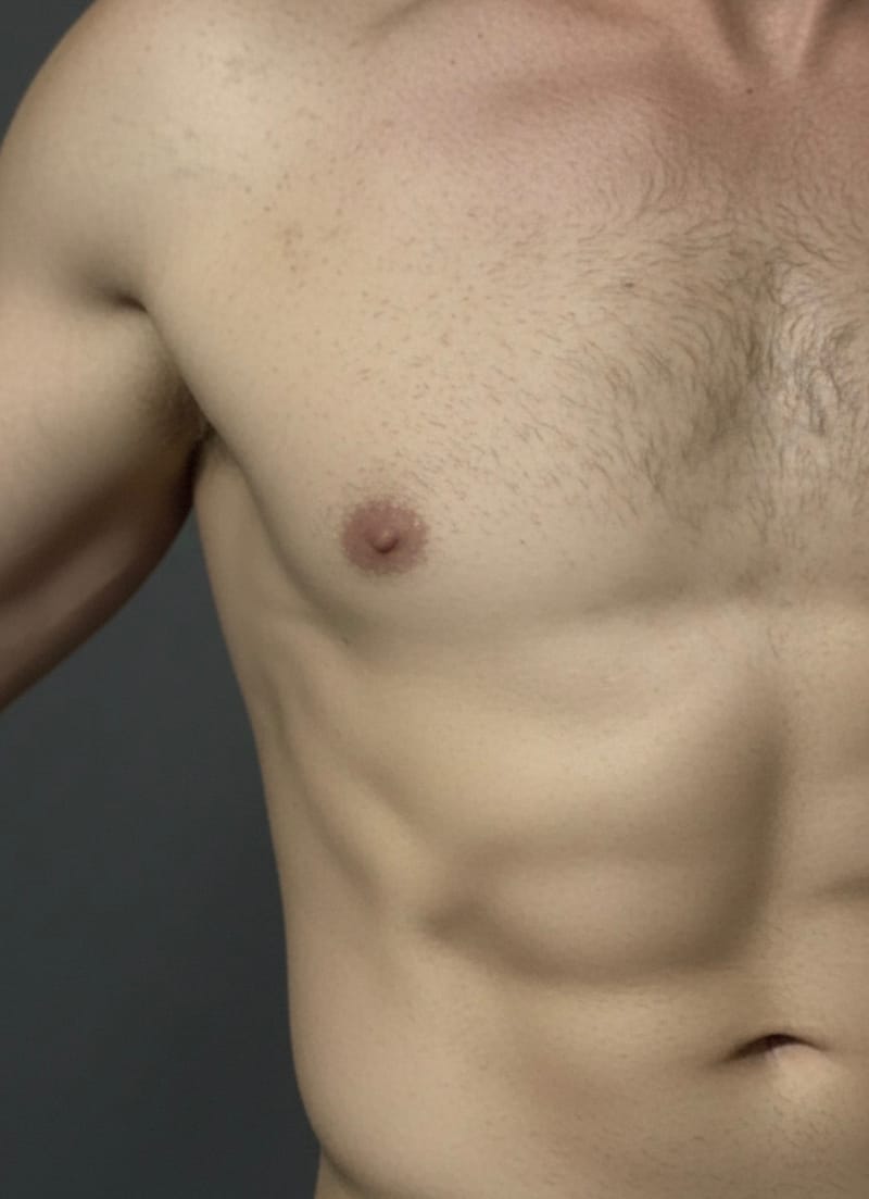 Advanced Body Contouring in Birmingham