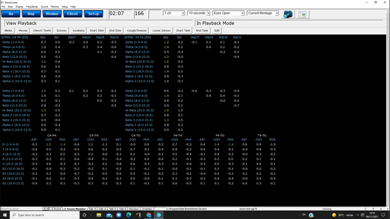 Z Scores and Normative Database