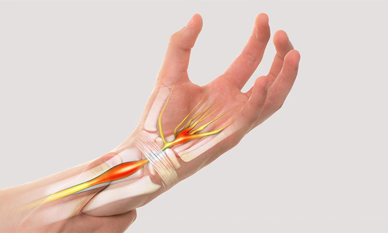 Carpal Tunnel Syndrome & Shiatsu Therapy.