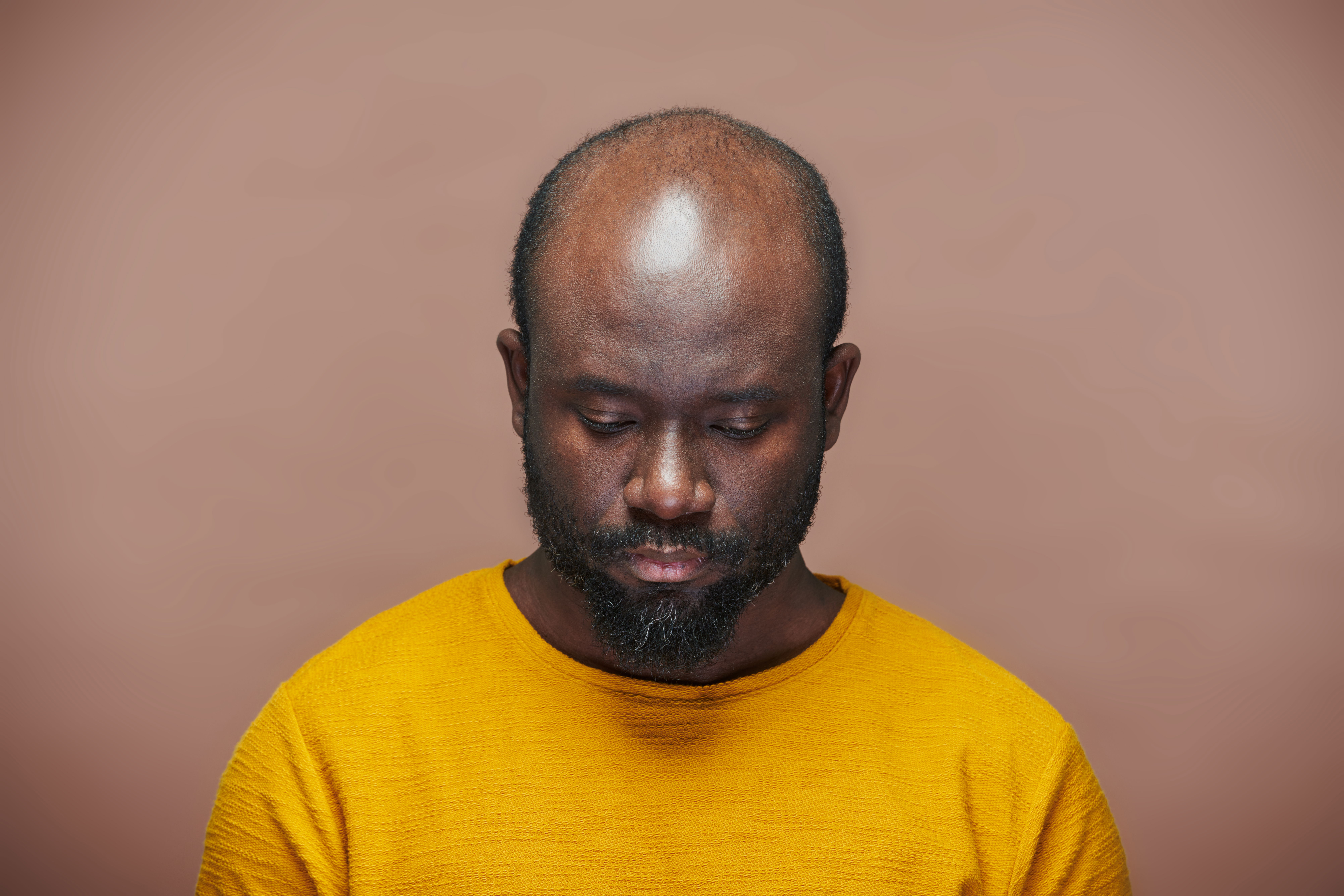 GREFFE CAPILAIRE POUR AFRICAIN