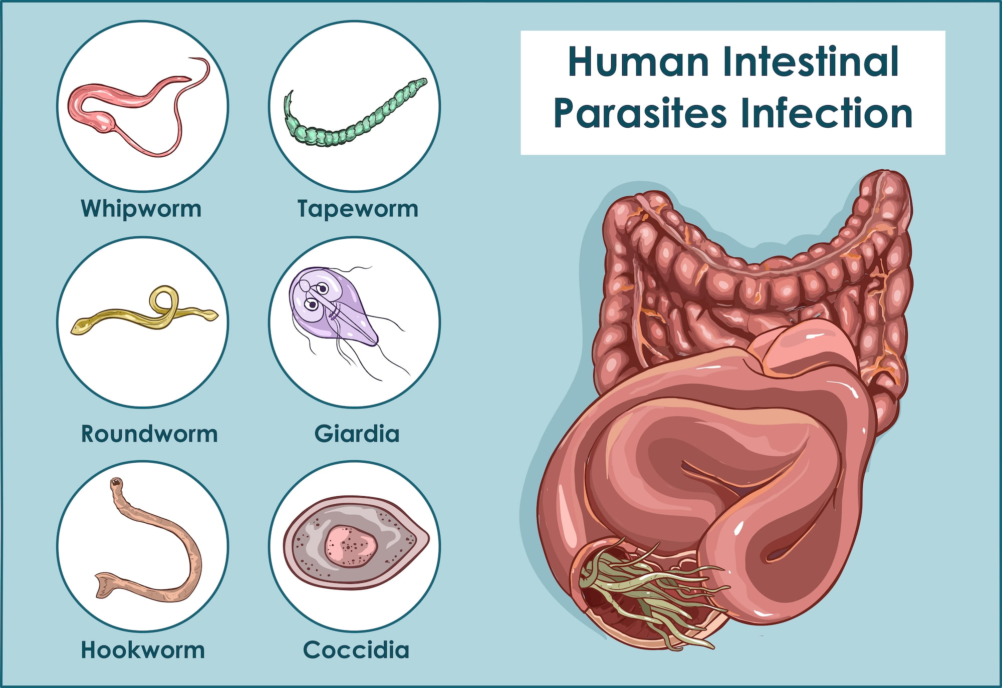 HOME REMEDIES FOR INTESTINAL WORMS