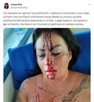 Agresión a Nelly, portavoz de Stop Abolición