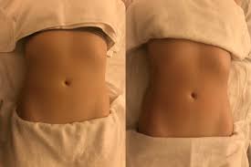 The Fluid Body: Why Lymphatic Drainage Massage is the Ultimate Tool for Cellular Detoxification and Immune Resilience