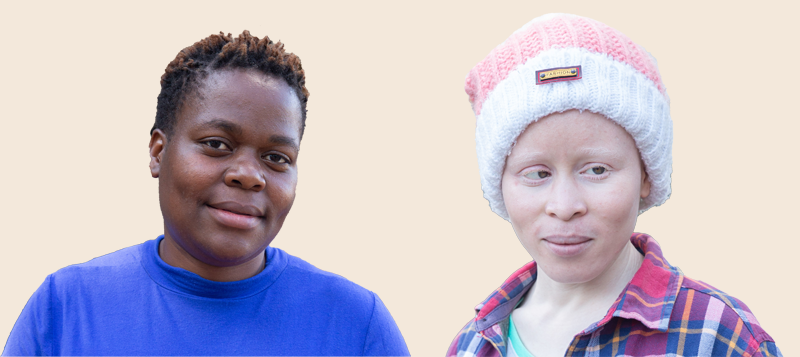 A side by side photo of two women, one with albinism another with out.