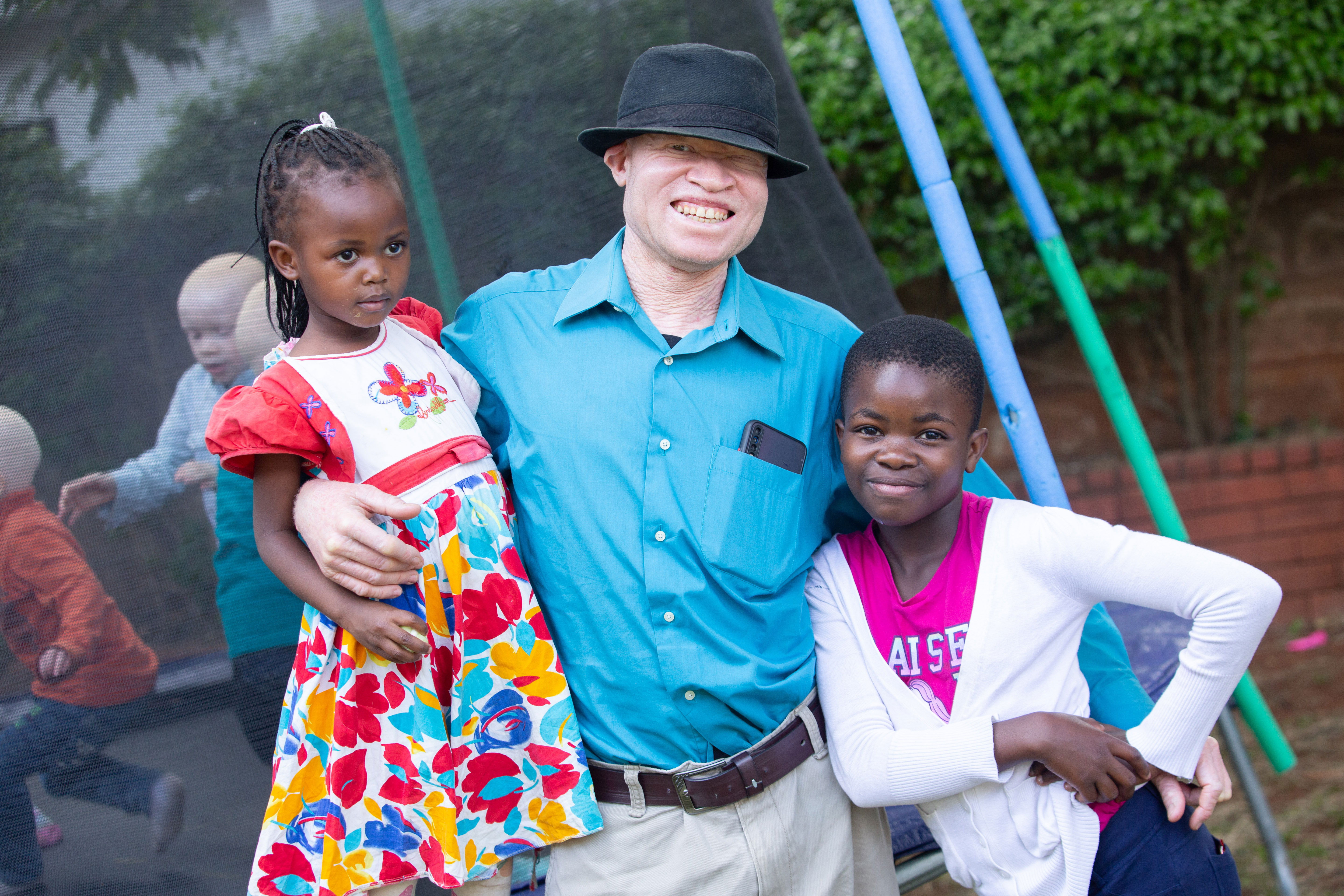 A man with albinism and his two daughters.