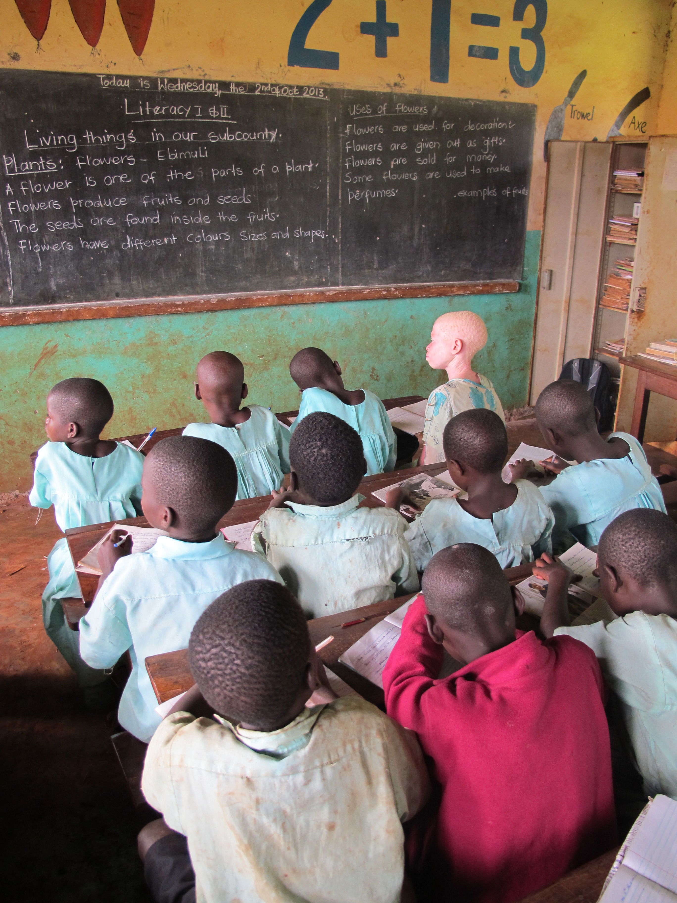 A classroom with one student with albinism