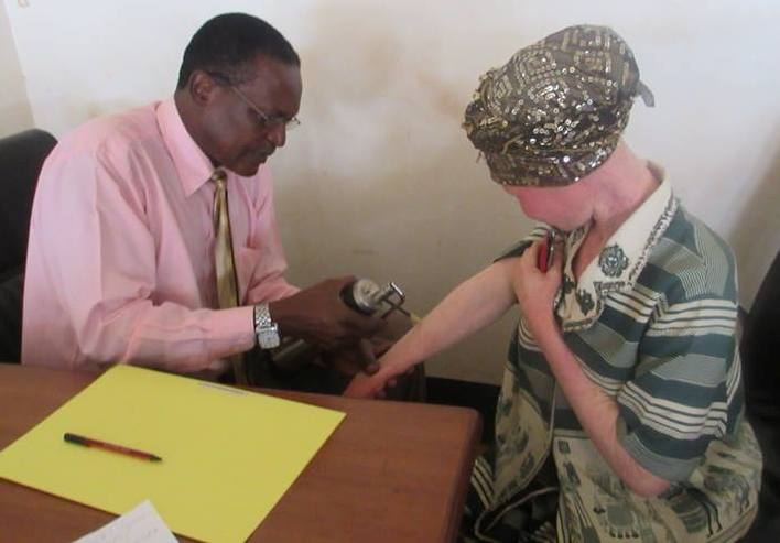 A doctor taking a lady with albinism through Albinism Cryotherapy