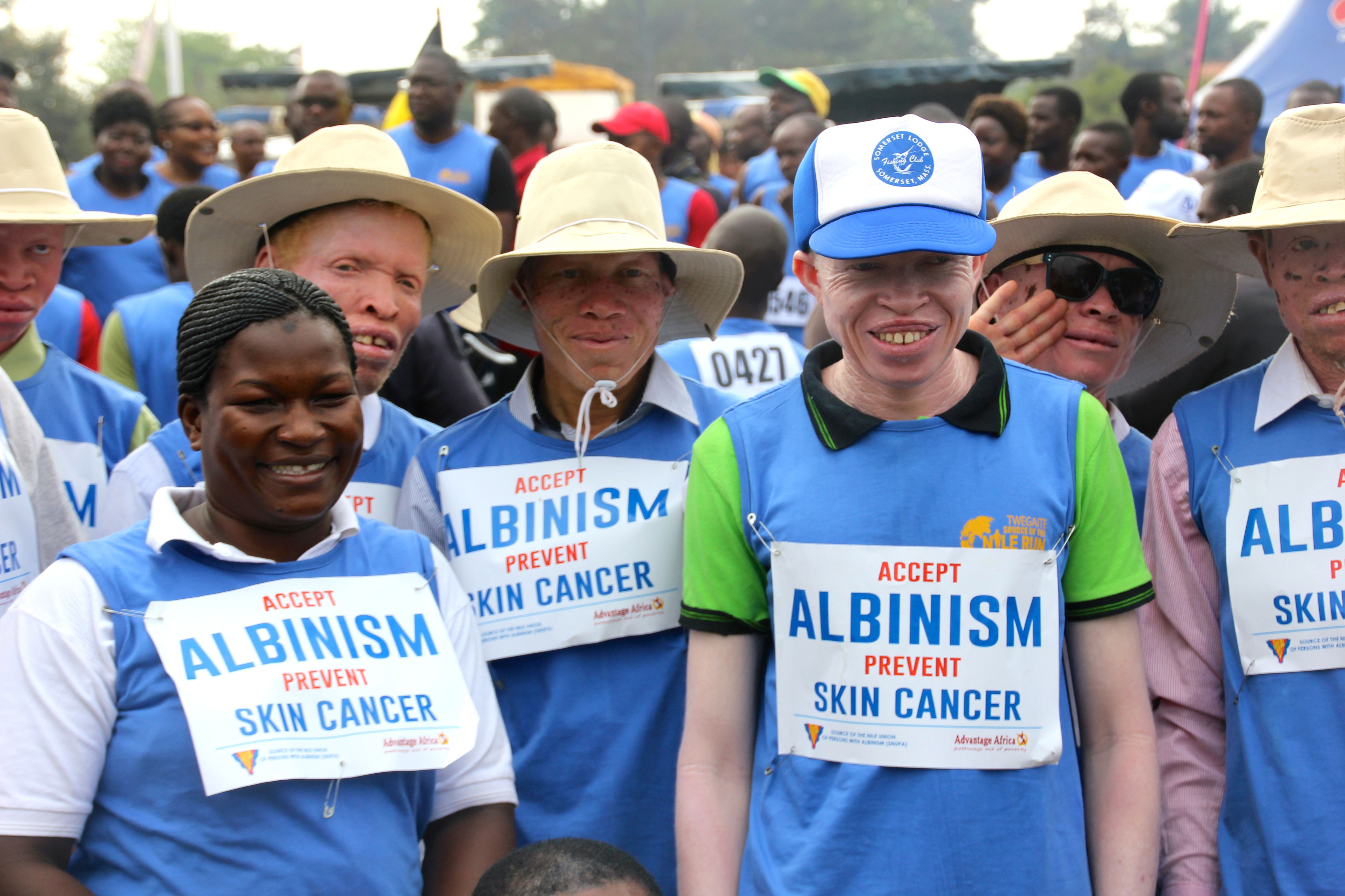 A group of people with albinism during a marathon.