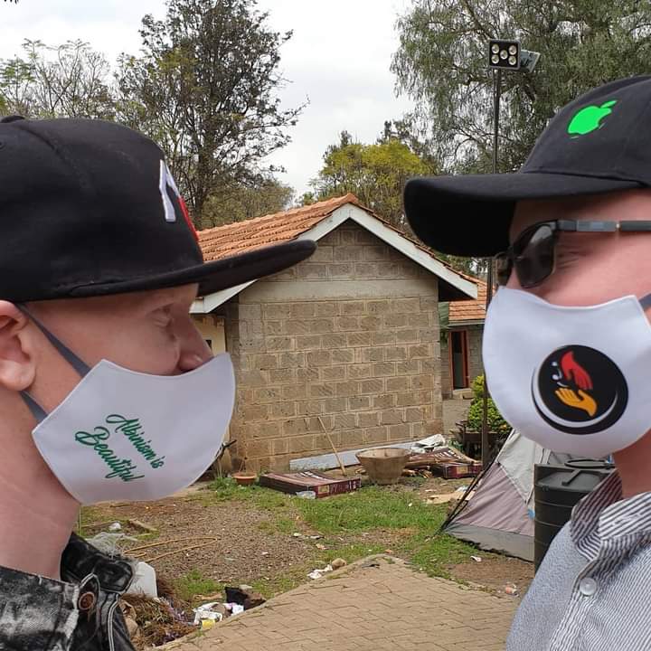 Two persons with albinism facing each other while wearing masks.