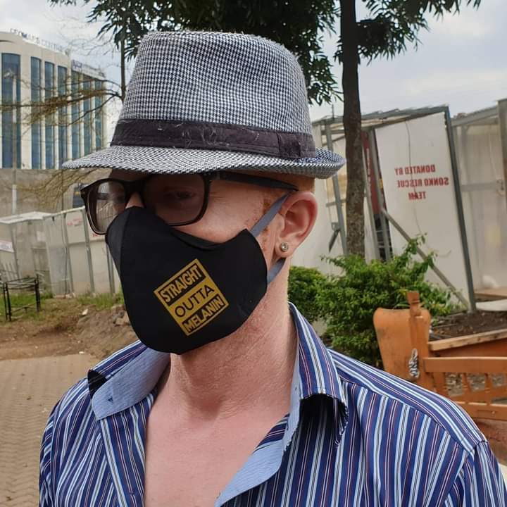 A person with albinism wearing a branded mask advocating for the rights of persons with albinism during the pandemic.