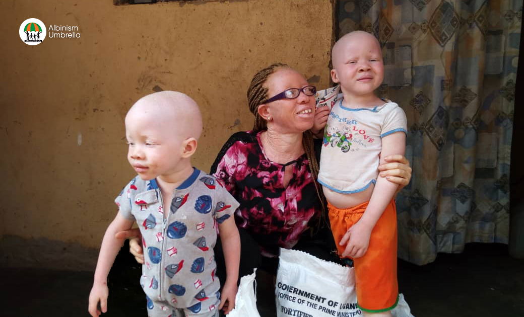 A picture of a lady with albinism with two kids with albinism.