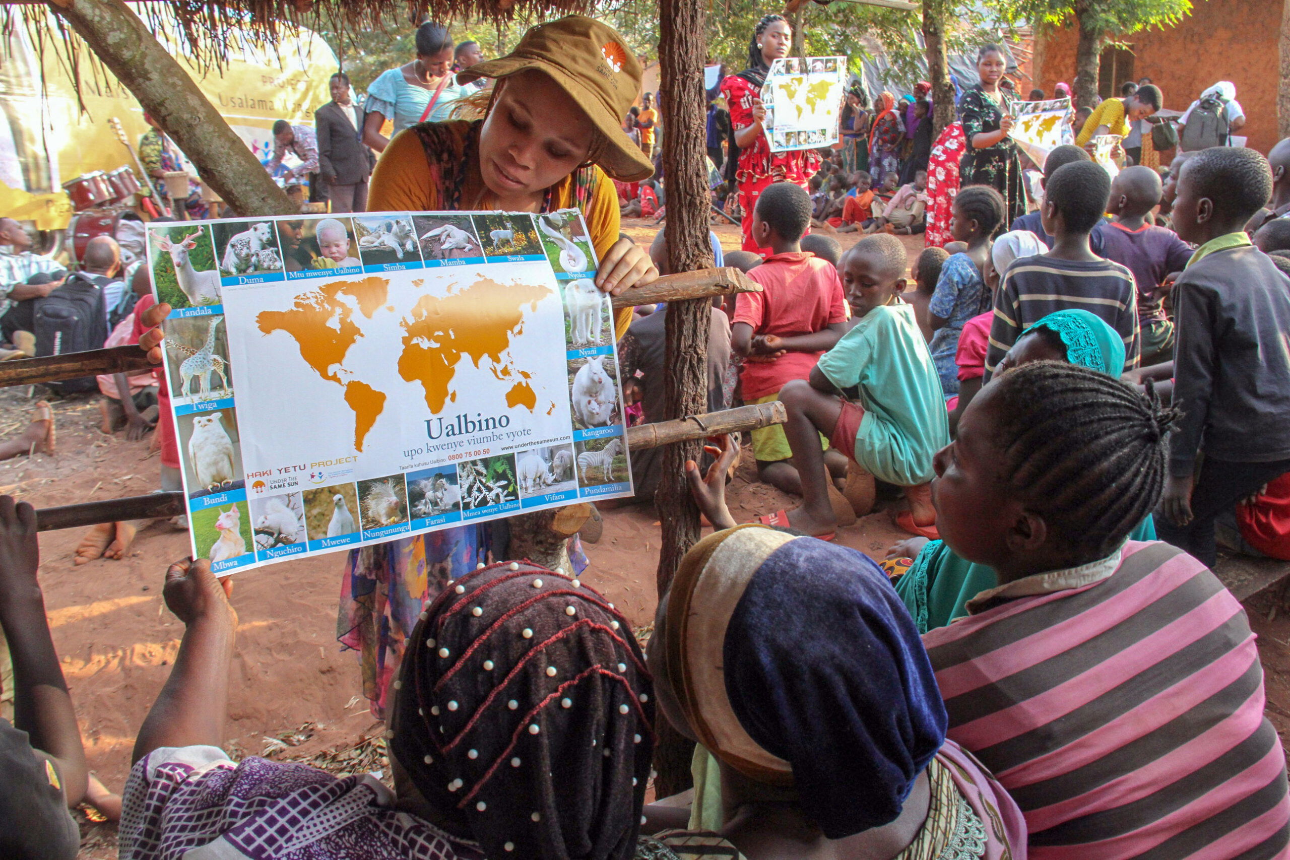 A lady with albinism education children on albinism