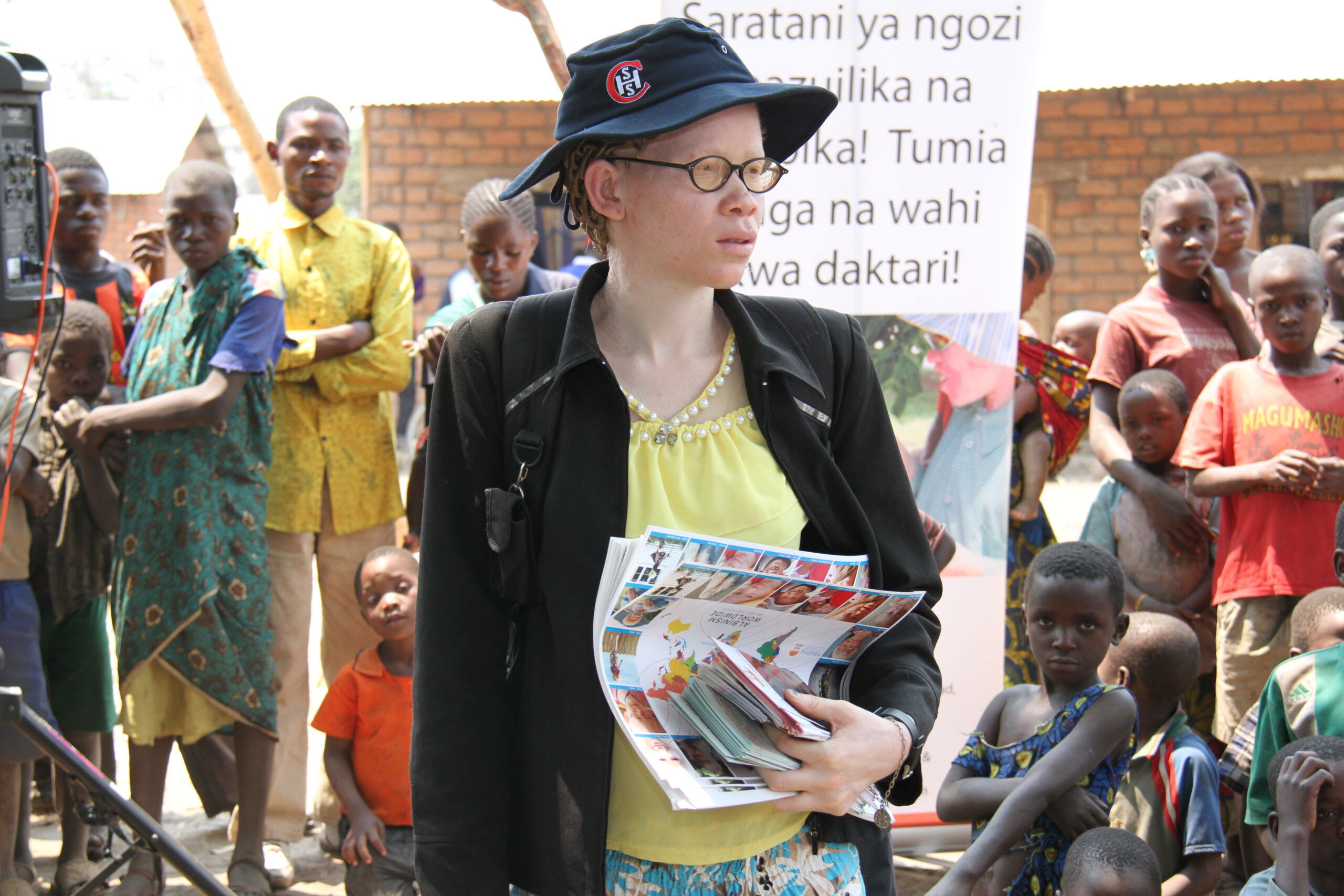 A lady with albinism educating the public on matters albinism