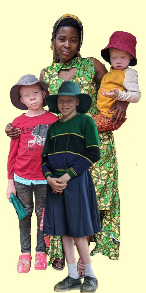 A picture of a woman holding three children with albinism