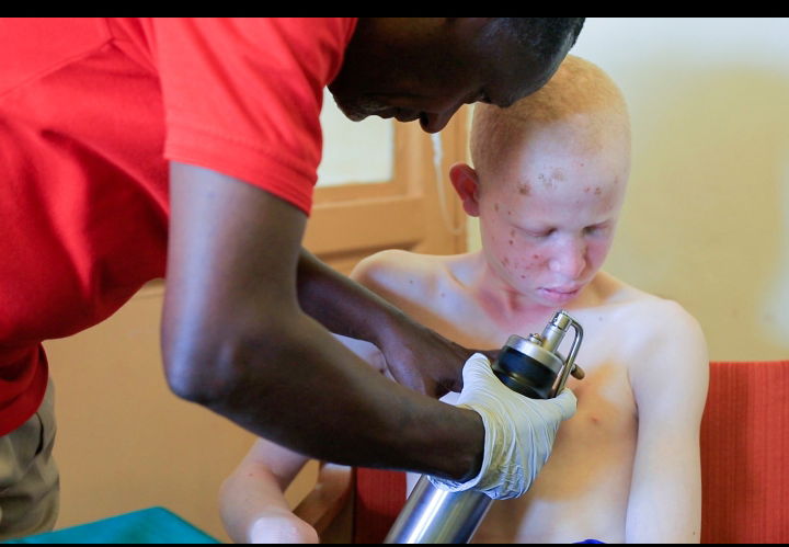 A healthcare practitioner checking out a young boy with albinism