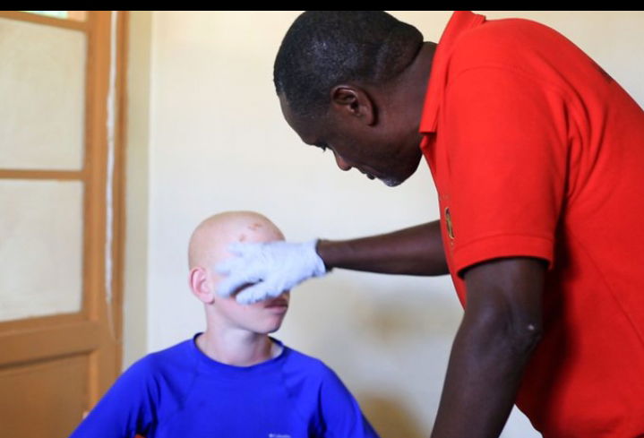 A health practitioner checking out a person with albinism