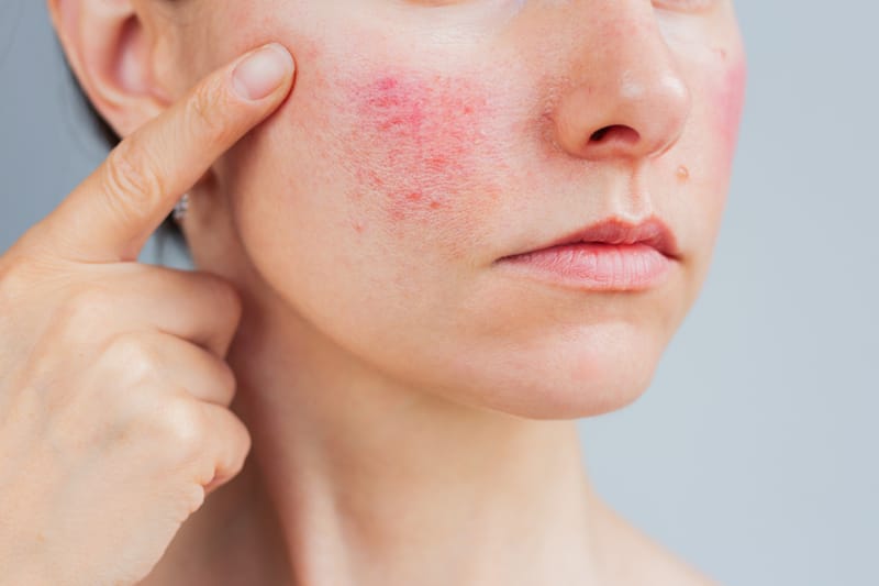 Sensitive & Barier CARE