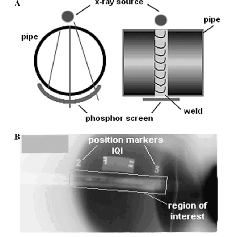 Digital Radiography (DR)