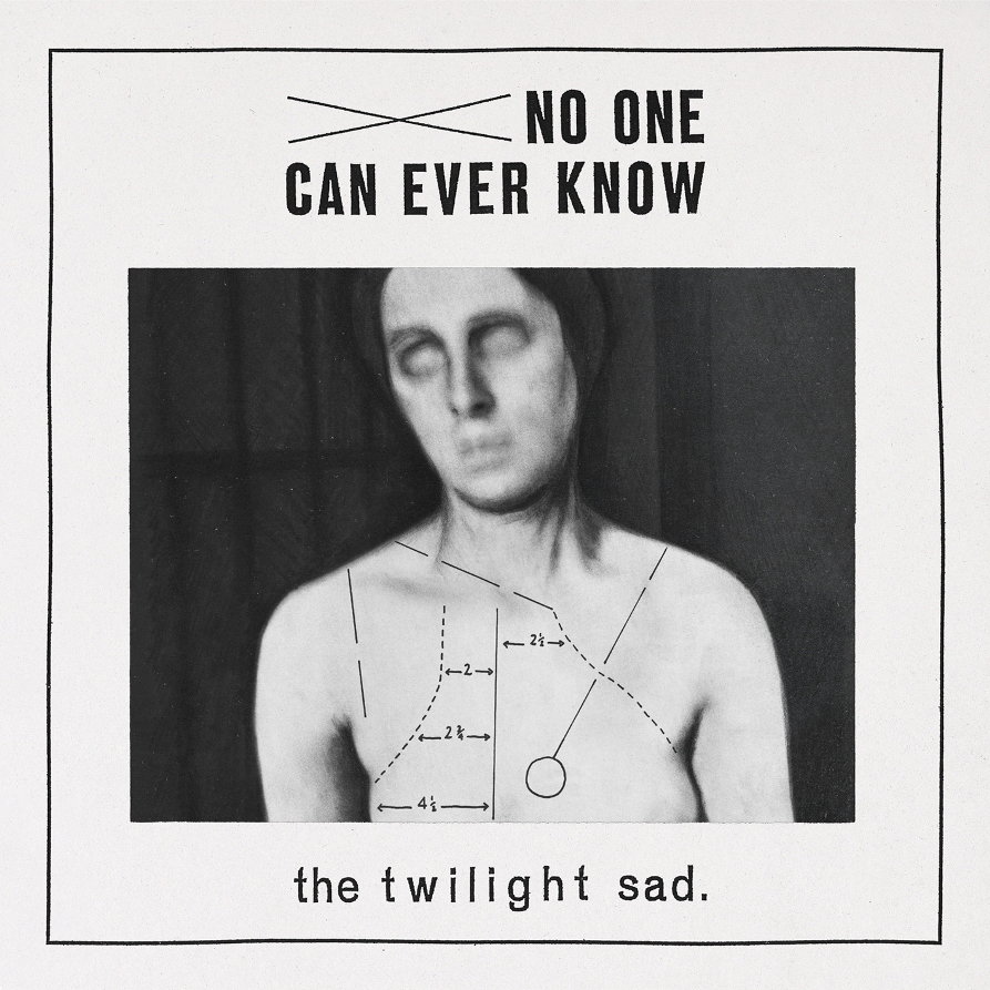 The Twilight Sad - No One Can Ever Know - Fat Cat Records - Mix Assistant/Assistant Engineer - LISTEN►