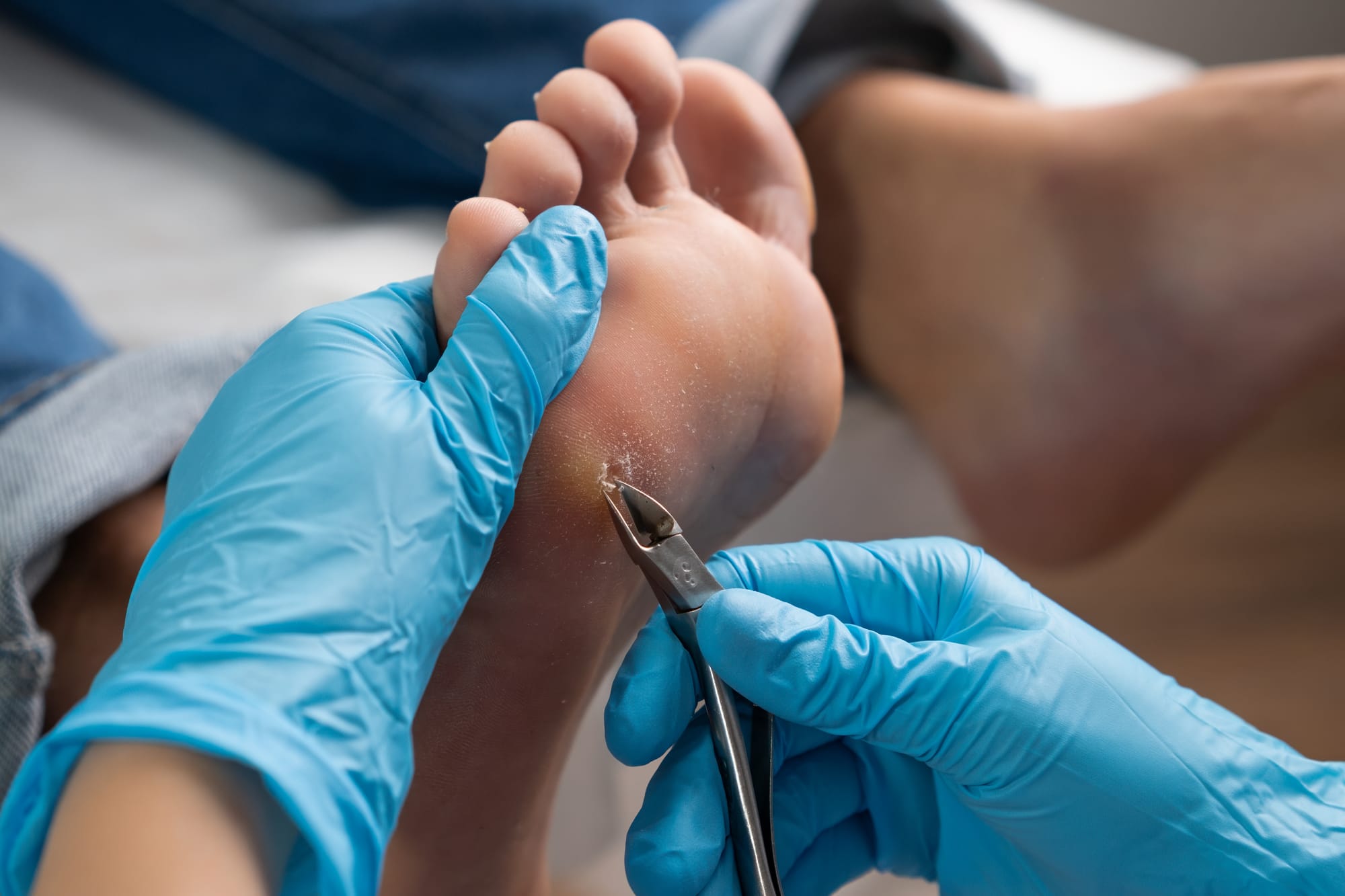 PODOLOGÍA CLINICA