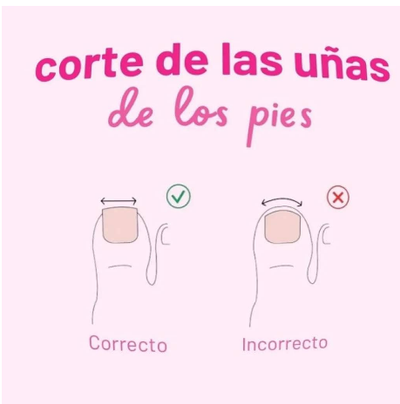 👣 CUIDA TUS UÑAS CON LA FORMA CORRECTA DE CORTE - Por Lorena Prieto, Podóloga de Centro Sigalit