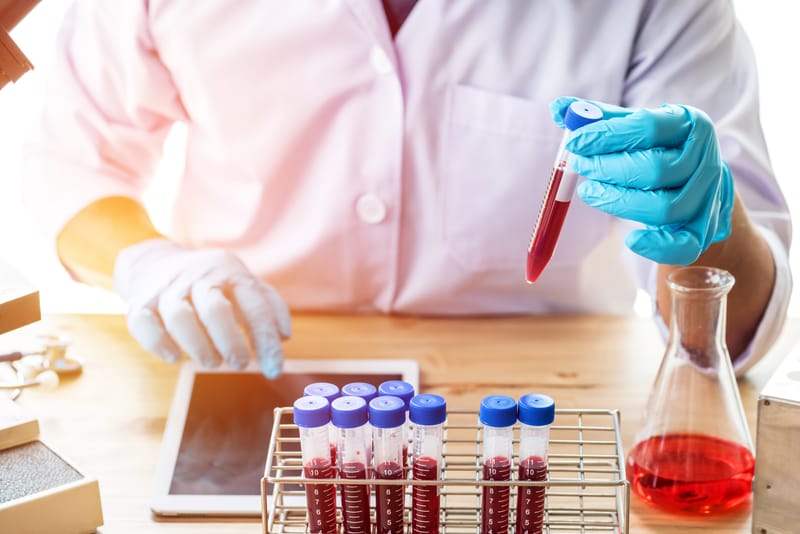 Handling OOS Test Results and Robust Investigations